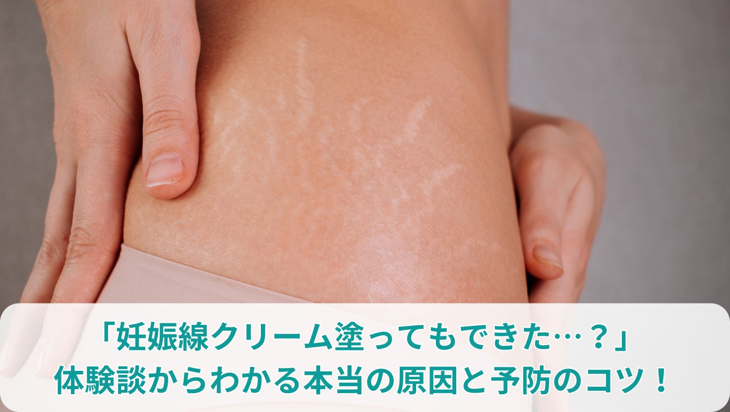 「妊娠線クリーム塗ってもできた…？」体験談からわかる本当の原因と予防のコツ！